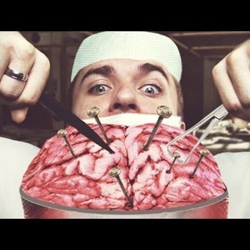 Brain Attack