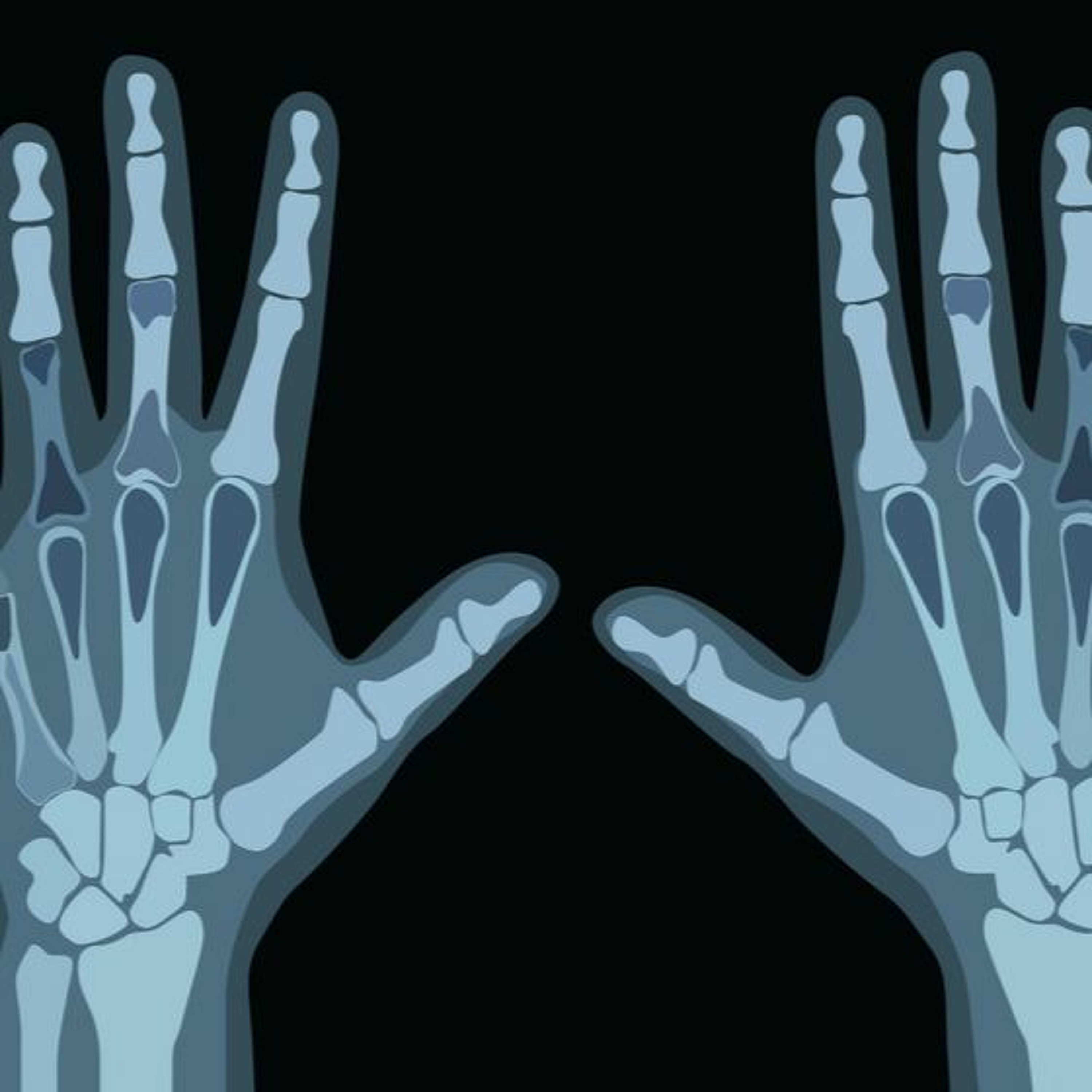 Automatic Hands episode artwork