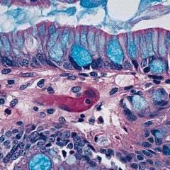 Love of my life (cover) by Jim Brickman