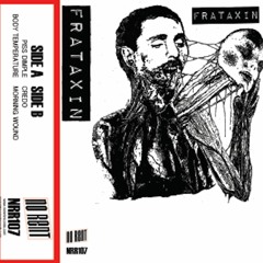 Frataxin - "Piss Dimple"