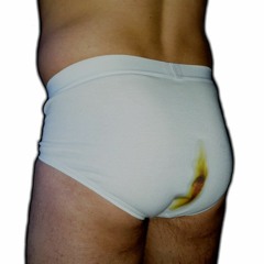 Fecal Incontinence
