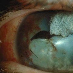 ☺AUSSCHNITT Teil 2  "Once through the club °°go on mushrooms°° and back"