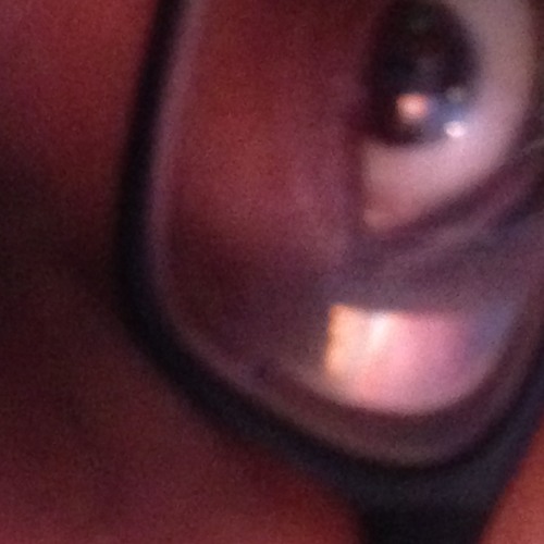 hurted