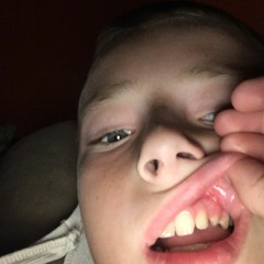 Slapperzz☄️🔥💥