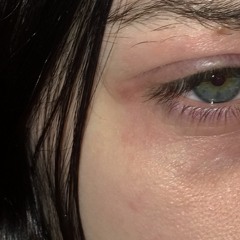 Tears Burn