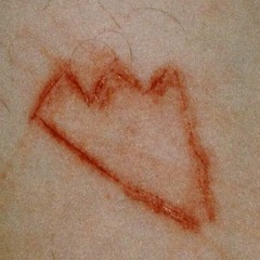 TUMMY TUCK (XXX ''LICK'' VERSE)