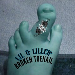 BROKEN TOENAIL (PROD. BMBEATS)