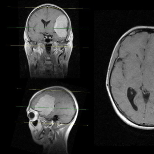 Театр Яда - Болезнь