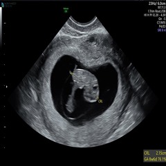 Clear Blue Freestyle