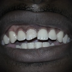 Take II