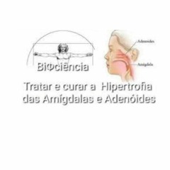 Tratar E Curar A Hipertrofia Das Amigdalas E Adenoides.(Amigdalite)