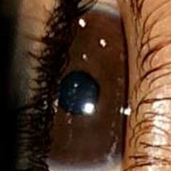 Xxxtentacion teeth(cover)