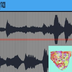 ZDR - ARARARARARAR