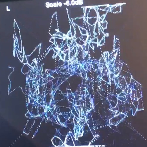 Stream hand crushed by a mallet (Jjaro remix)[fka backwoodblaise] by