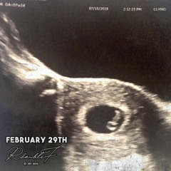 Brodie NY - February 29th