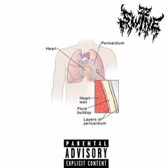 PERICARDIECTOMY (prod. mutru)