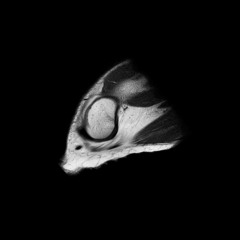 B2. Microtonal Crack Music