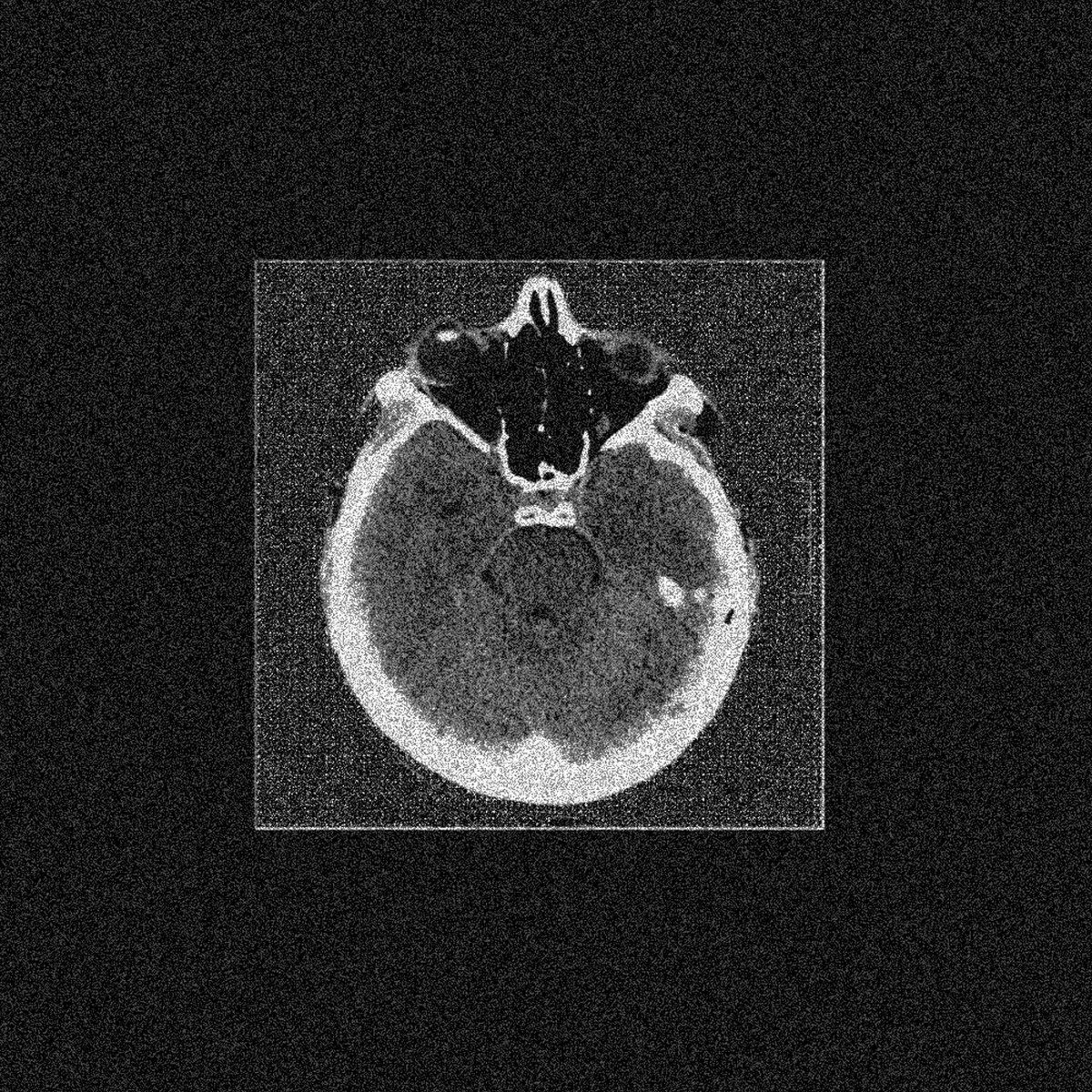 Zobol - Foreign Objects [SCI-FACT]