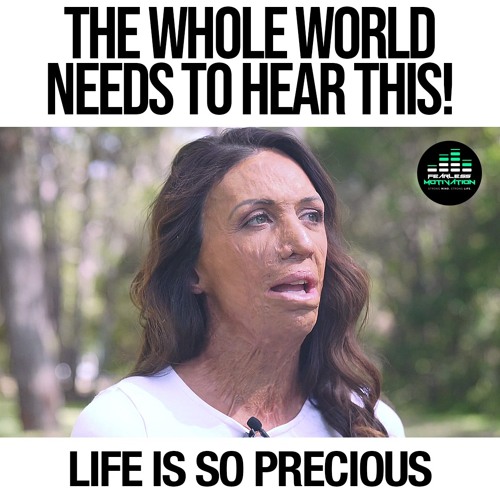 TURIA PITT - The Whole World Needs To Hear This
