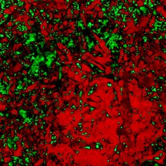 Dry Eye (prod Eem Triplin)