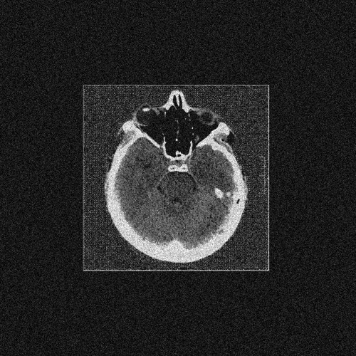 Zobol - Diagnosis Error