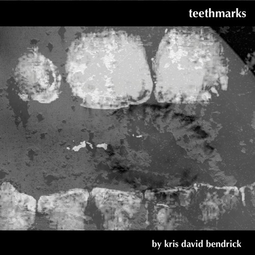 teethmarks