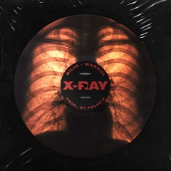 X-Ray feat БИЛИК