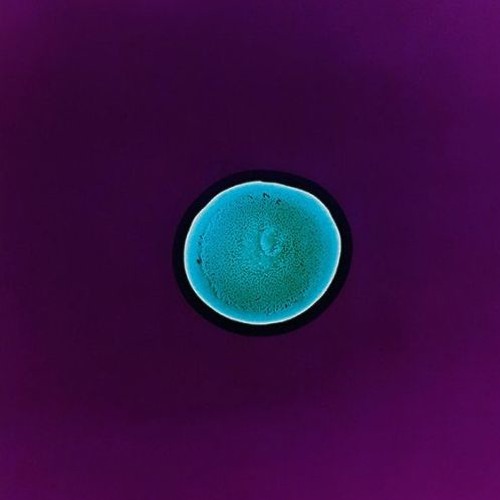 Mishel A - Raznica