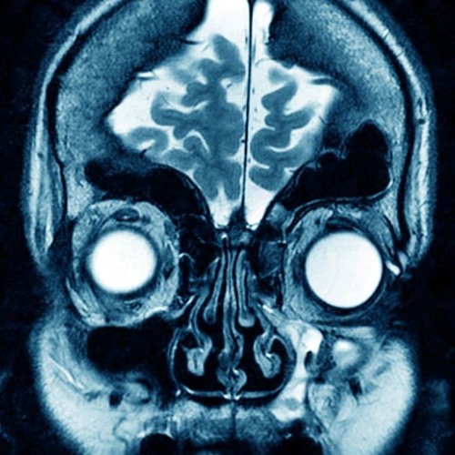 Unidentified Object - Disordered minds