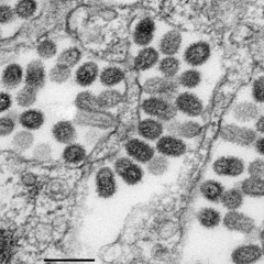 (2014) - Symptoms Of Smallpox (REMASTERD)