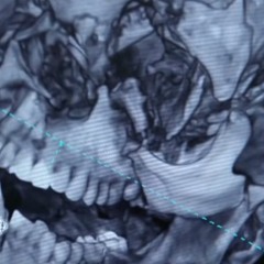 MARU - FILTER RMX (LEAK) prod. Jacques Norri$