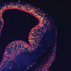 Lil Peep And Lil Tracy - Witchblades (CV7 N DR4GG3D)