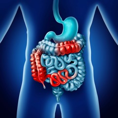 Enfermedad de Crohn