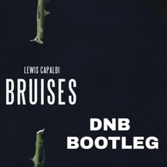 Lewis Capaldi - Bruises (DOUBLE RUKUZ DNB BOOTLEG)