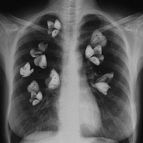 intermission - lameboysharp (ft. unkknown artist)