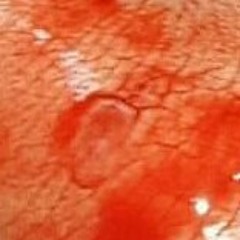 JANI-I BLED IT(prod.pilgrim)