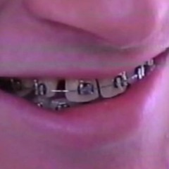 Diet Riot - Xposer of the Poser LP_tape rip