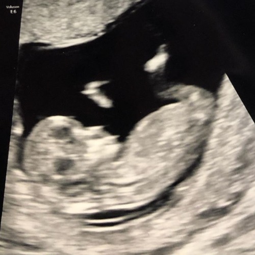 Daddy's Home (f@mbly remix)