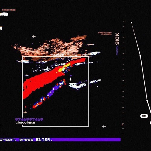 Mussy - Sick (prod. Schumi)