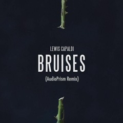 Lewis Capaldi - Bruises (AudioPrism Remix)