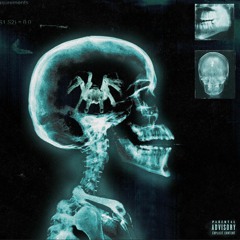 Paraplegic (feat. Woop)