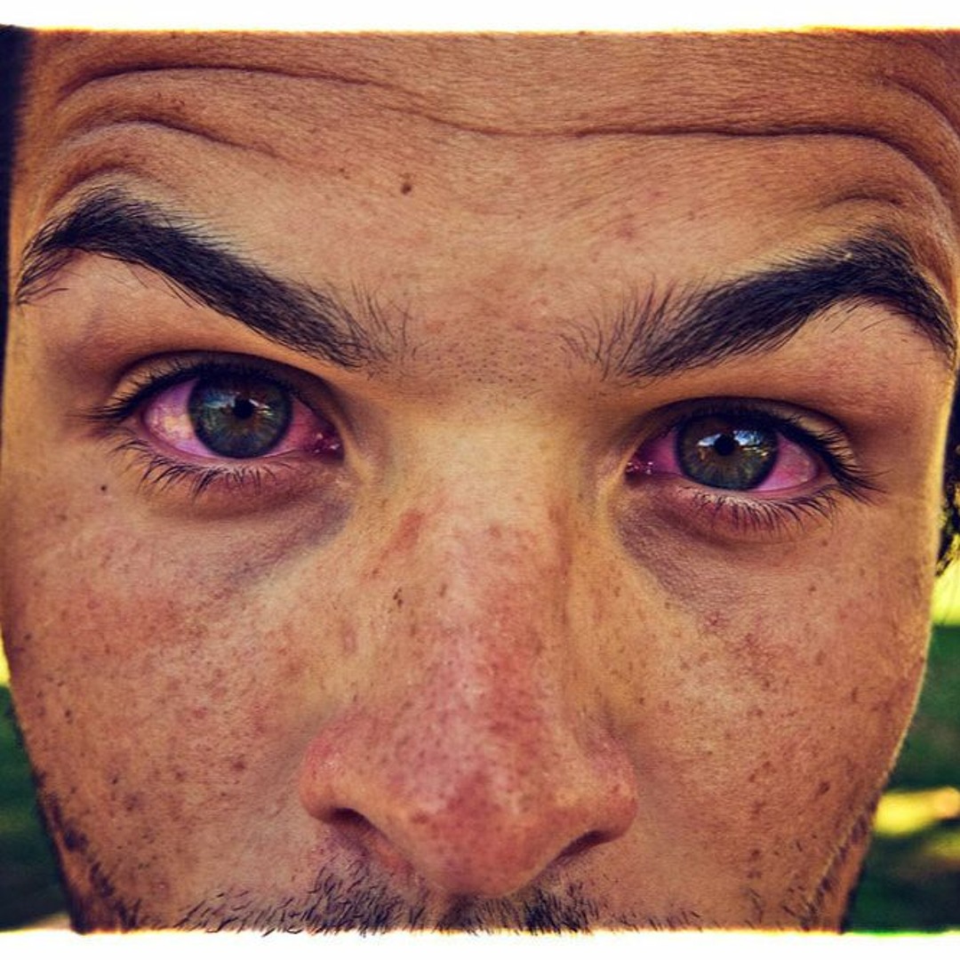 Слёзы на щеках. Игровые приставки ps3 super slim 500 гб corda ode юла. Ятрышник кукушкины слезки. Gc 4. Красивые слезы.