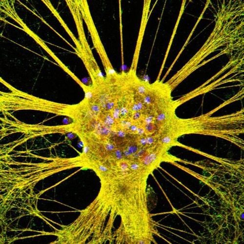 NeuroDistortionIntraAxonik