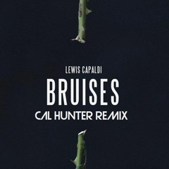 Lewis Capaldi - Bruises (cal hunter remix)