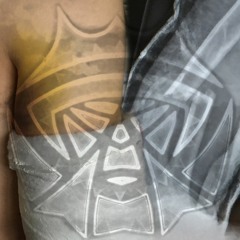 Bruise Marks & Bone Destruction