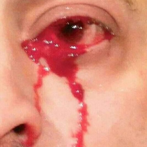 Headbutt and Run