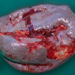 quand le ciel bas et lourd