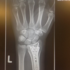 Undertow - featuring Julie Roelsgaard