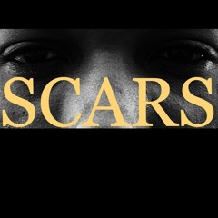 SCARS