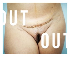 This Is Only Rock'N'Roll